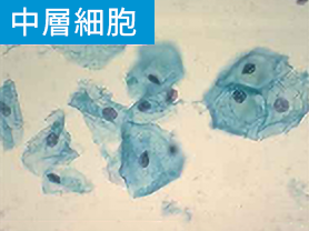  中層細胞（＝排卵後〜分泌期）