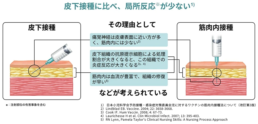 図：筋肉内接種で痛みを軽減