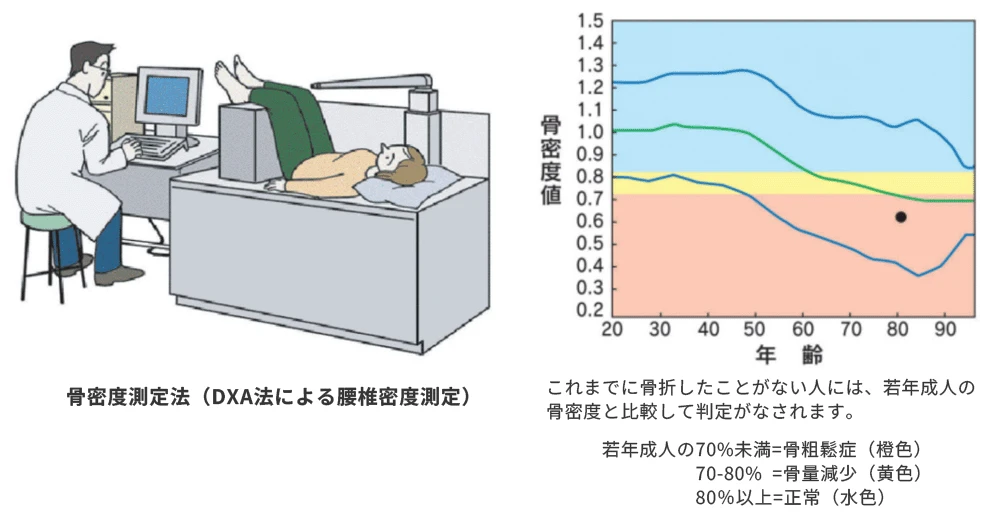 代表的な検査