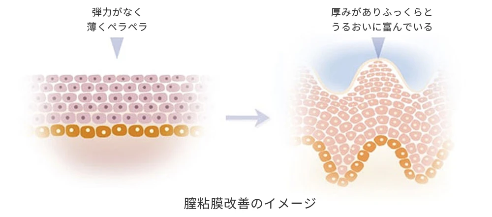 【図】膣粘膜上皮の変化